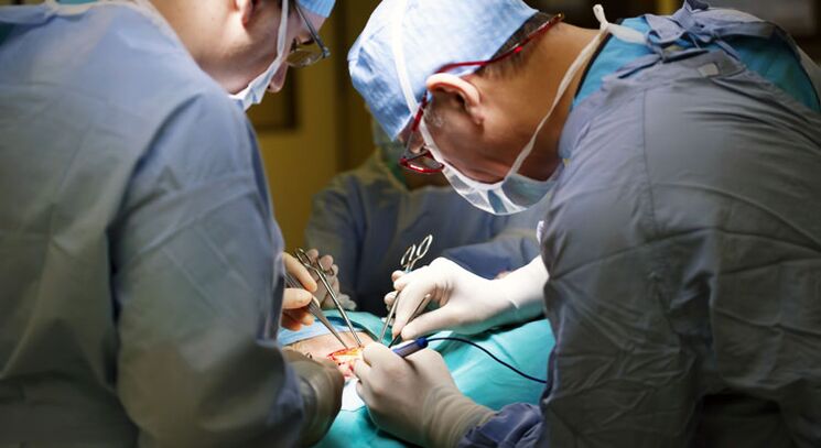 Cirurgia é realizada em estágios avançados de prostatite crônica em homens